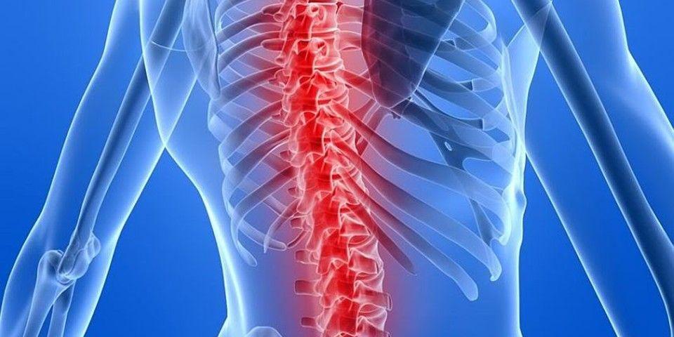 Image for Why Would You Need Spinal Decompression Surgery? with ID of: 6026399