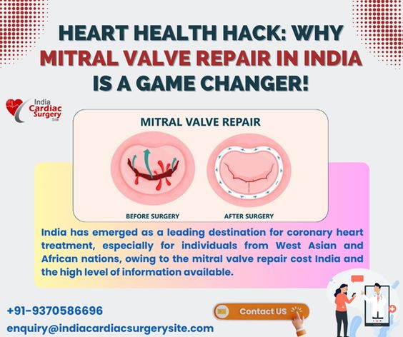 Image for Mitral Valve Repair in India with ID of: 6035811