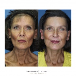 Image for Grossman Capraro Plastic Surgery with ID of: 4701866