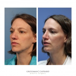 Image for Grossman Capraro Plastic Surgery with ID of: 4701867