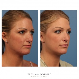 Image for Grossman Capraro Plastic Surgery with ID of: 4704427