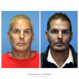 Image for Grossman Capraro Plastic Surgery with ID of: 4704428