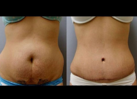 Image for Dr. Carlton Scroggins Plastic Surgeon with ID of: 4720748