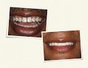 Image for J Han Dental Design with ID of: 4726473