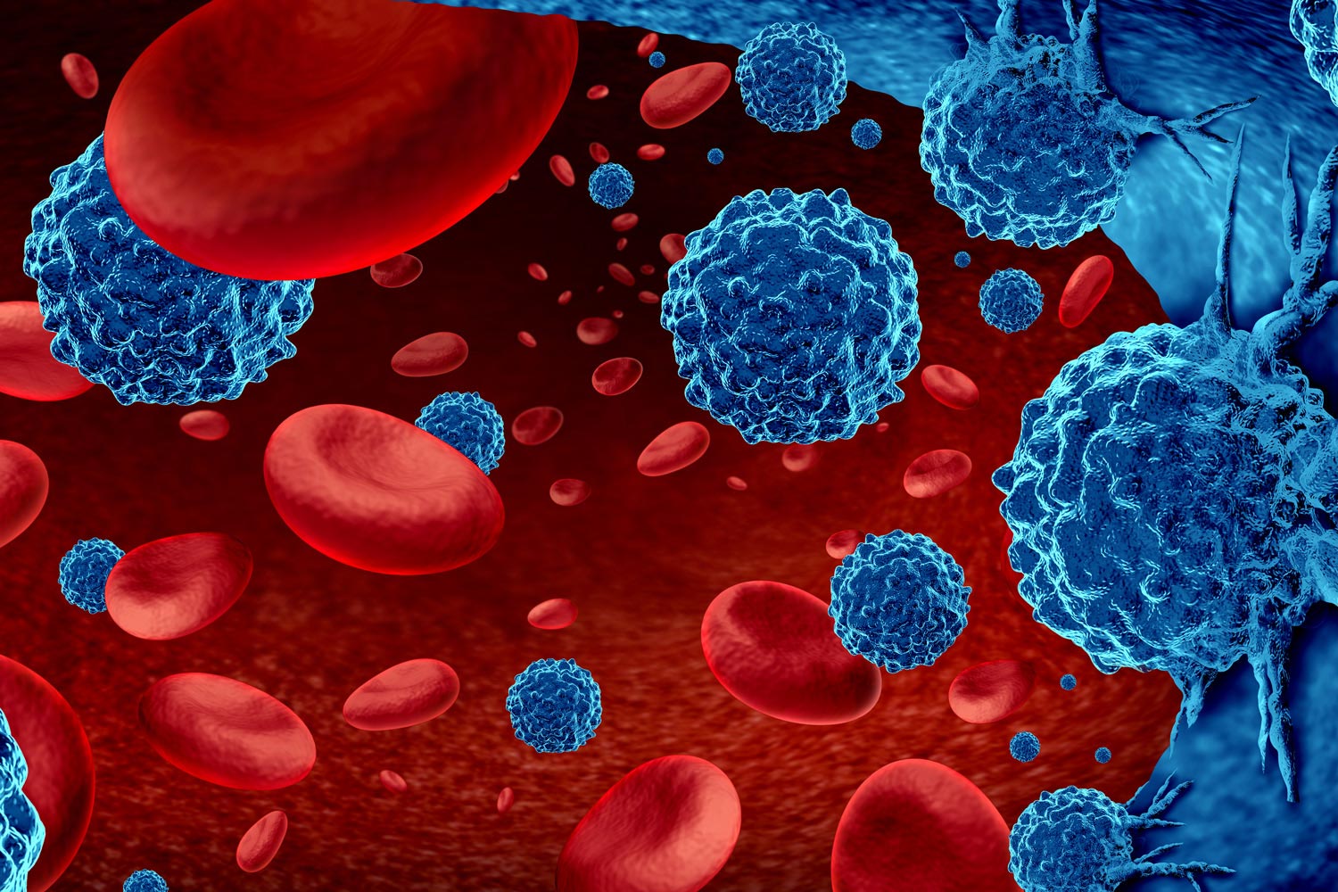 Image for Hematologic Malignancies Market: Global Industry Analysis 2032 with ID of: 6074801
