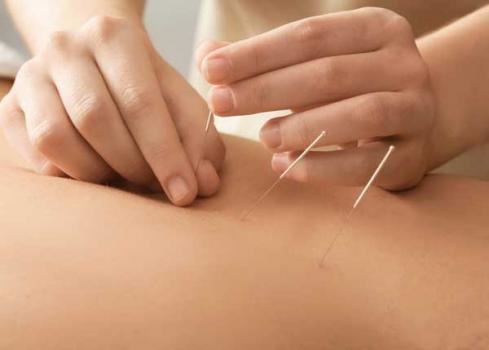 Image for Peak Physical Therapy & Wellness - Parker with ID of: 4769272