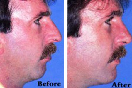 Image for Ent Allergy & Sinus Center with ID of: 4780149