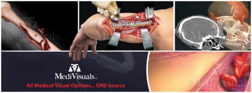 Image for Medivisuals Inc with ID of: 4841012