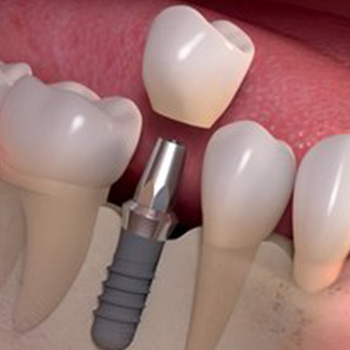 Image for Maylands Dental Centre with ID of: 4874426