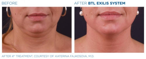 Image for Golden Laser Aesthetics with ID of: 4891593