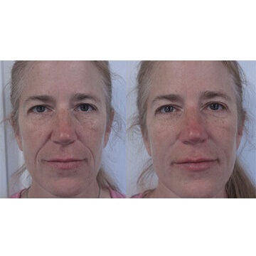 Image for Dr. Christine Rodgers - Denver Plastic Surgery with ID of: 4969979