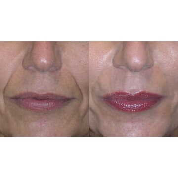 Image for Dr. Christine Rodgers - Denver Plastic Surgery with ID of: 4969980