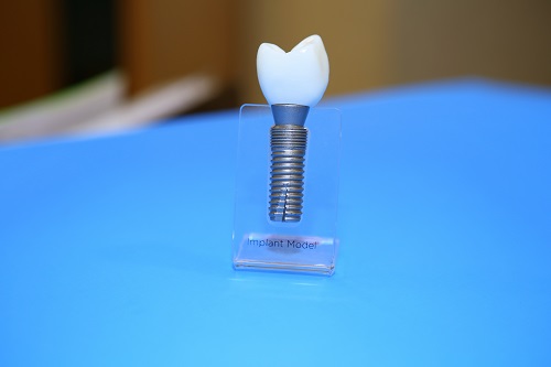 Image for State Valley Dental with ID of: 5009047
