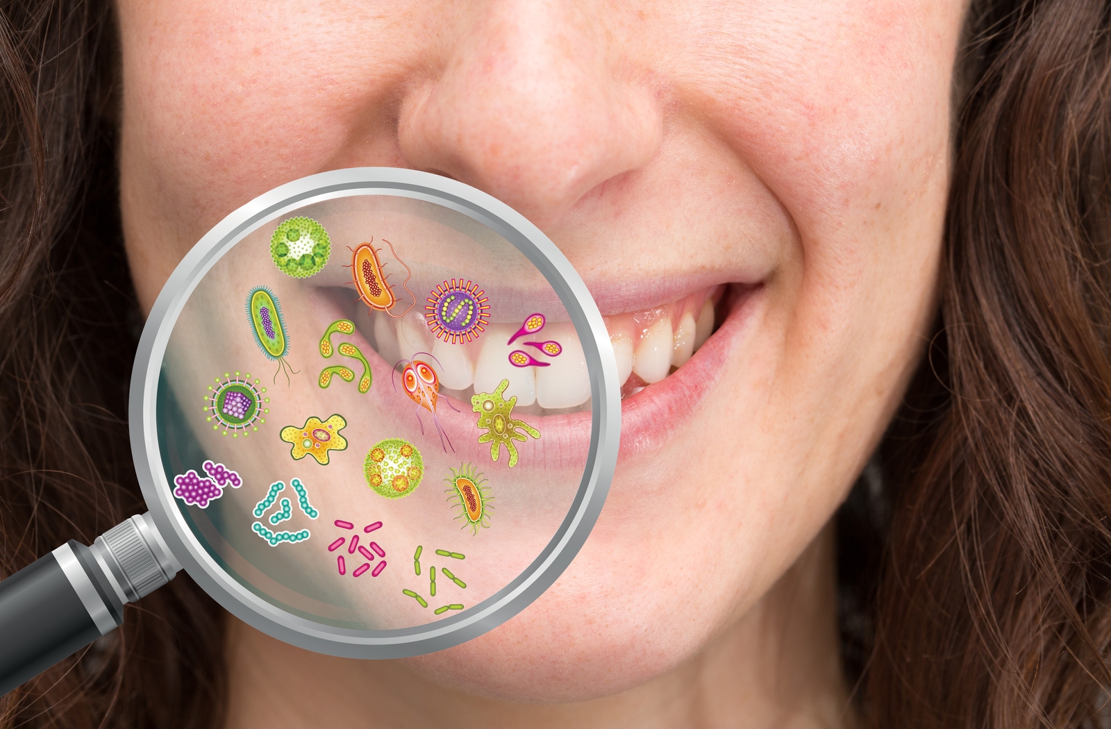 Image for 5 Hard-to-Detect Yet Highly Dangerous Dental Diseases with ID of: 6177529