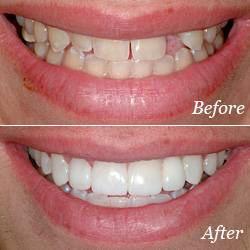 Image for Valley Village Dental with ID of: 618468