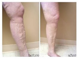 Image for Elite Vein Centers with ID of: 619105
