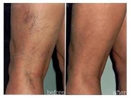 Image for Elite Vein Centers with ID of: 619107