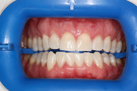 Image for Mile High Smiles with ID of: 5072390