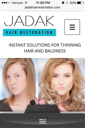 Image for Jadak Hair Restoration with ID of: 5099667