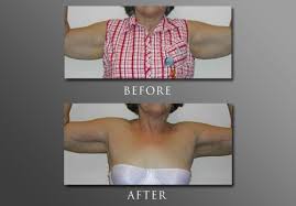 Image for Dr. Joseph Perlman - Advanced Plastic Surgery Center with ID of: 623844