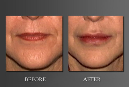 Image for Dr. Joseph Perlman - Advanced Plastic Surgery Center with ID of: 623845