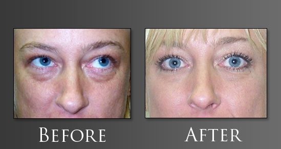 Image for Dr. Joseph Perlman - Advanced Plastic Surgery Center with ID of: 623846