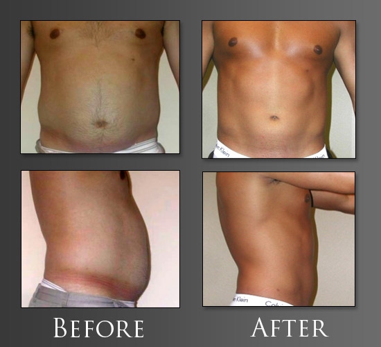 Image for Dr. Joseph Perlman - Advanced Plastic Surgery Center with ID of: 623847