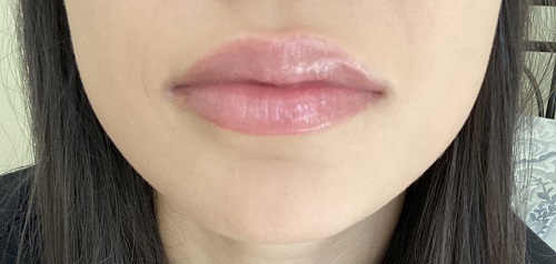 Image for Gig Harbor Aesthetics with ID of: 5208358
