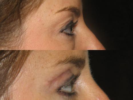 Image for New York Group for Plastic Surgery with ID of: 5238446
