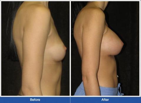 Image for New York Group for Plastic Surgery with ID of: 5238448