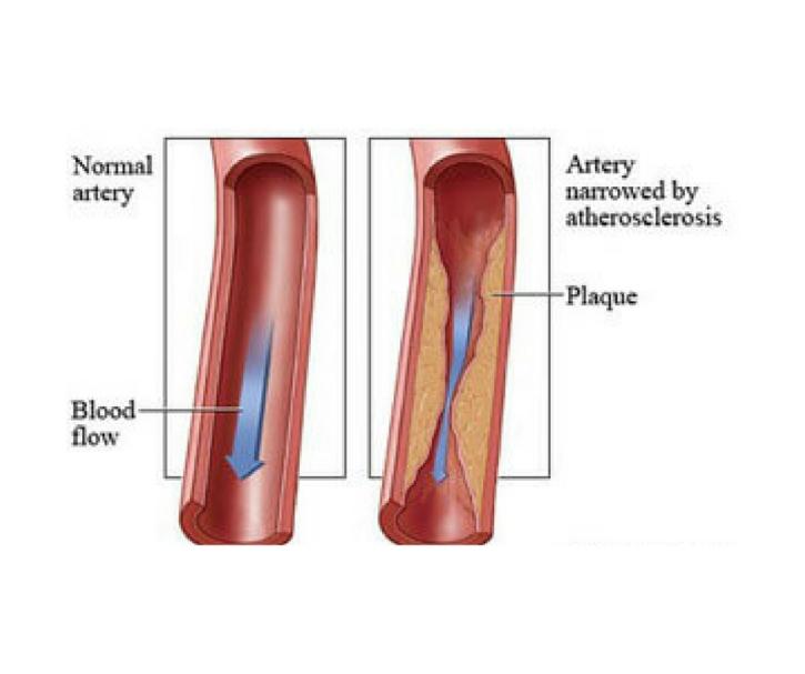 Image for USA Vascular Centers with ID of: 5265162