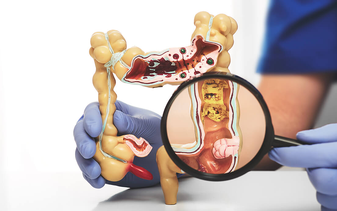 Image for Colorectal Surgery Market: Unveiling Competition, Size, and Robust Growth Prospects Through 2029 with ID of: 6283838