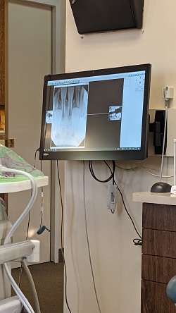 Image for Linna Golodriga, DDS - Burlingame Dentist with ID of: 5277065