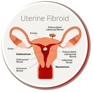 Image for USA Fibroid Centers with ID of: 5304470