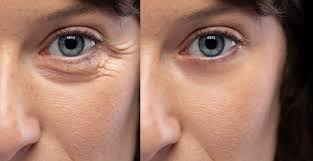 Image for Vitamin C and its effect on Dry skin with ID of: 5339259