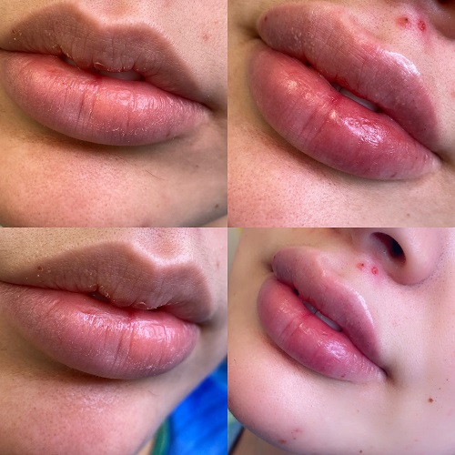Image for Lifted Beauty with ID of: 5354153