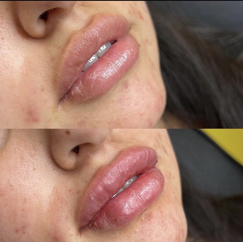 Image for Lifted Beauty with ID of: 5354167