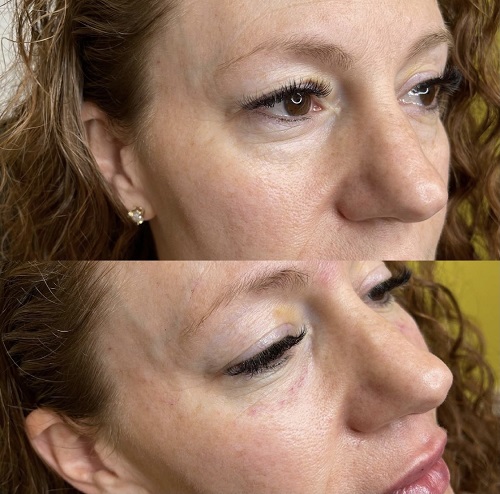 Image for Lifted Beauty with ID of: 5354170