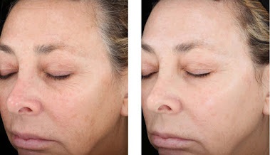 Image for SkinMD Seattle with ID of: 5366568