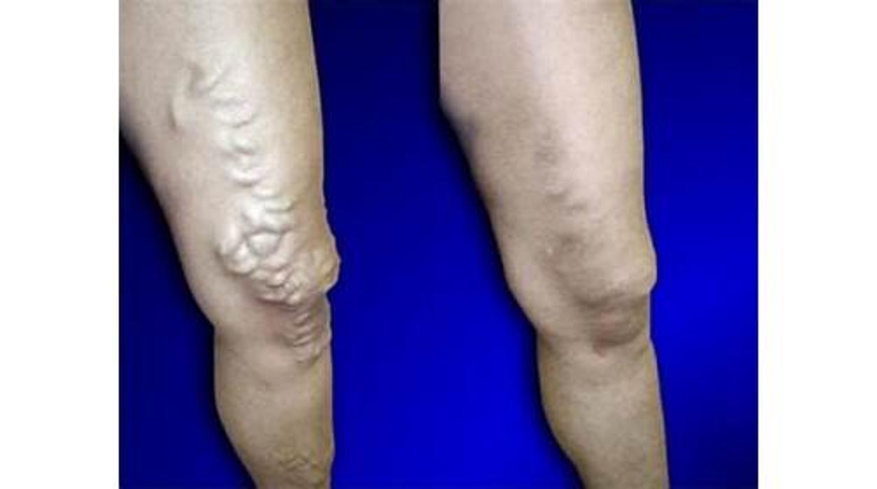 Image for USA Vein Clinics with ID of: 5367340