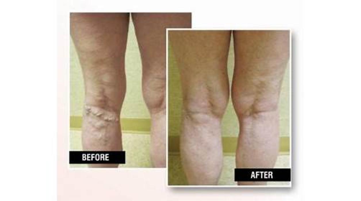 Image for USA Vein Clinics with ID of: 5367341