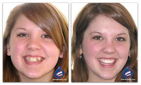 Image for Smile Visalia with ID of: 631679