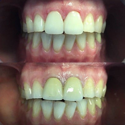 Image for Pasadena Smile Center with ID of: 5417415