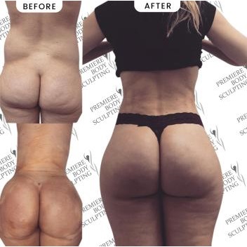 Image for Premiere Body Sculpting with ID of: 5419494