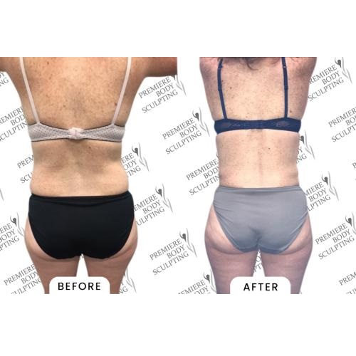 Image for Premiere Body Sculpting with ID of: 5419495