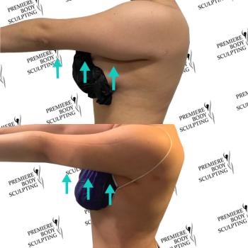 Image for Premiere Body Sculpting with ID of: 5419496