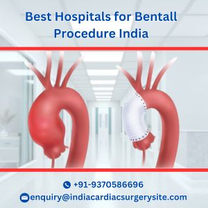 Image for Low Cost Bentall Procedure with ID of: 6341561
