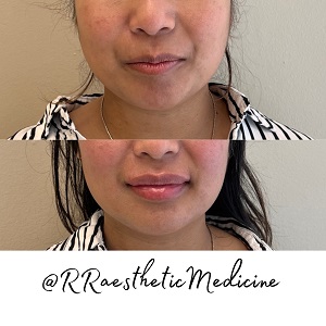 Image for R & R Aesthetic Medicine with ID of: 5462203