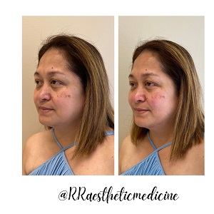 Image for R & R Aesthetic Medicine with ID of: 5462209