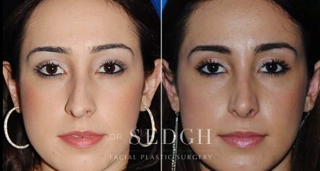 Image for Sedgh Plastic Surgery with ID of: 5475622
